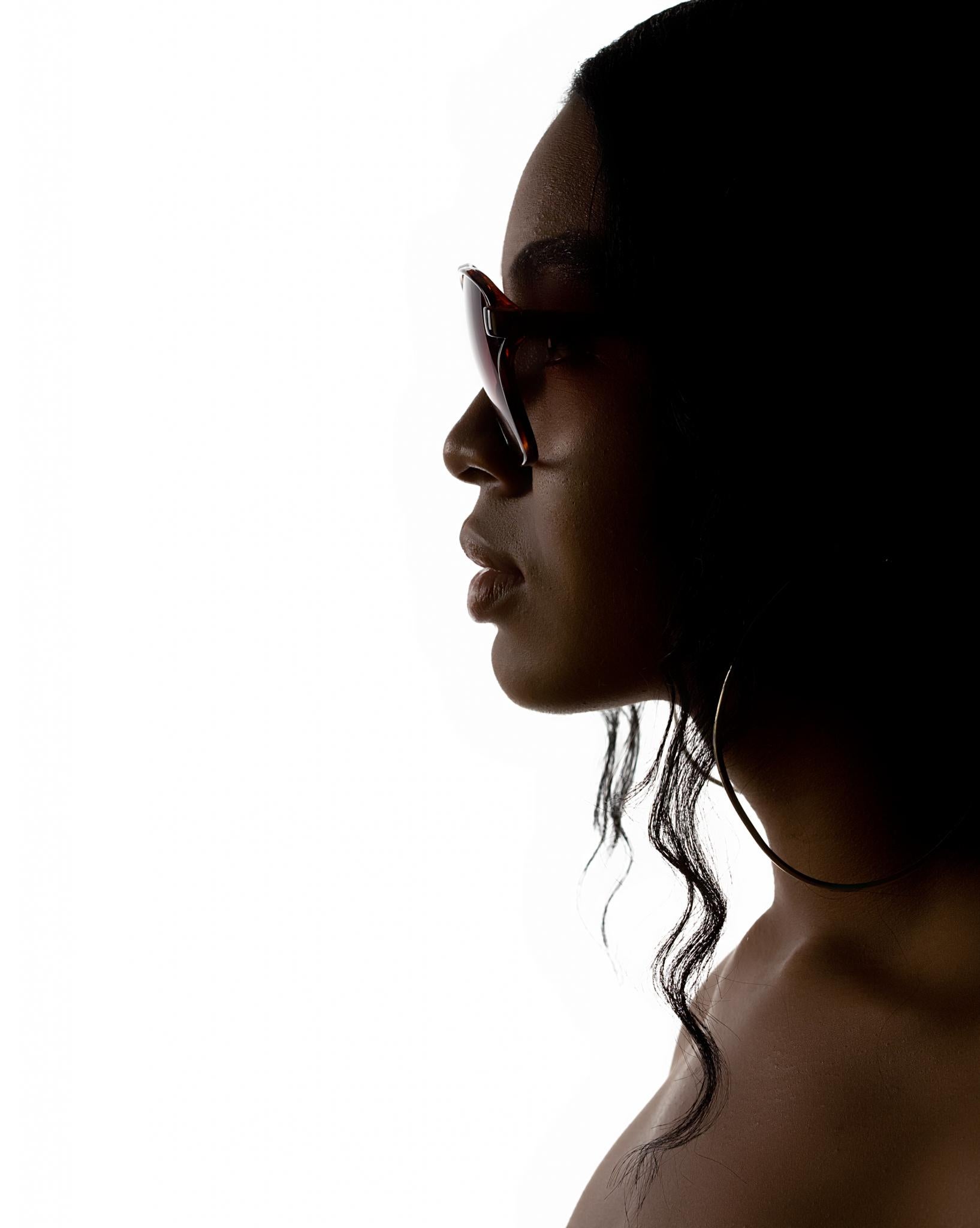 Ask The Experts: Will Hiding My Hair Loss With Weaves/Wigs Make It Worse?